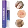 Wart Removing Pen