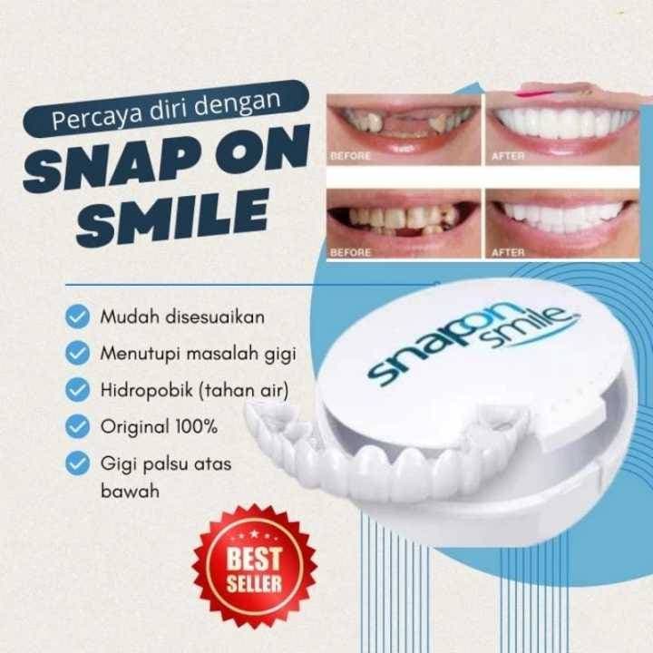  Snap On Smile 100% ORIGINAL Authentic USA thumbnail 4