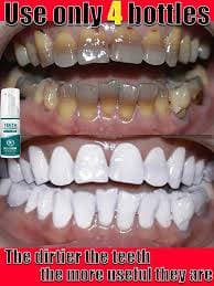 Teeth Whitening Foam To Remove Tartar thumbnail 3